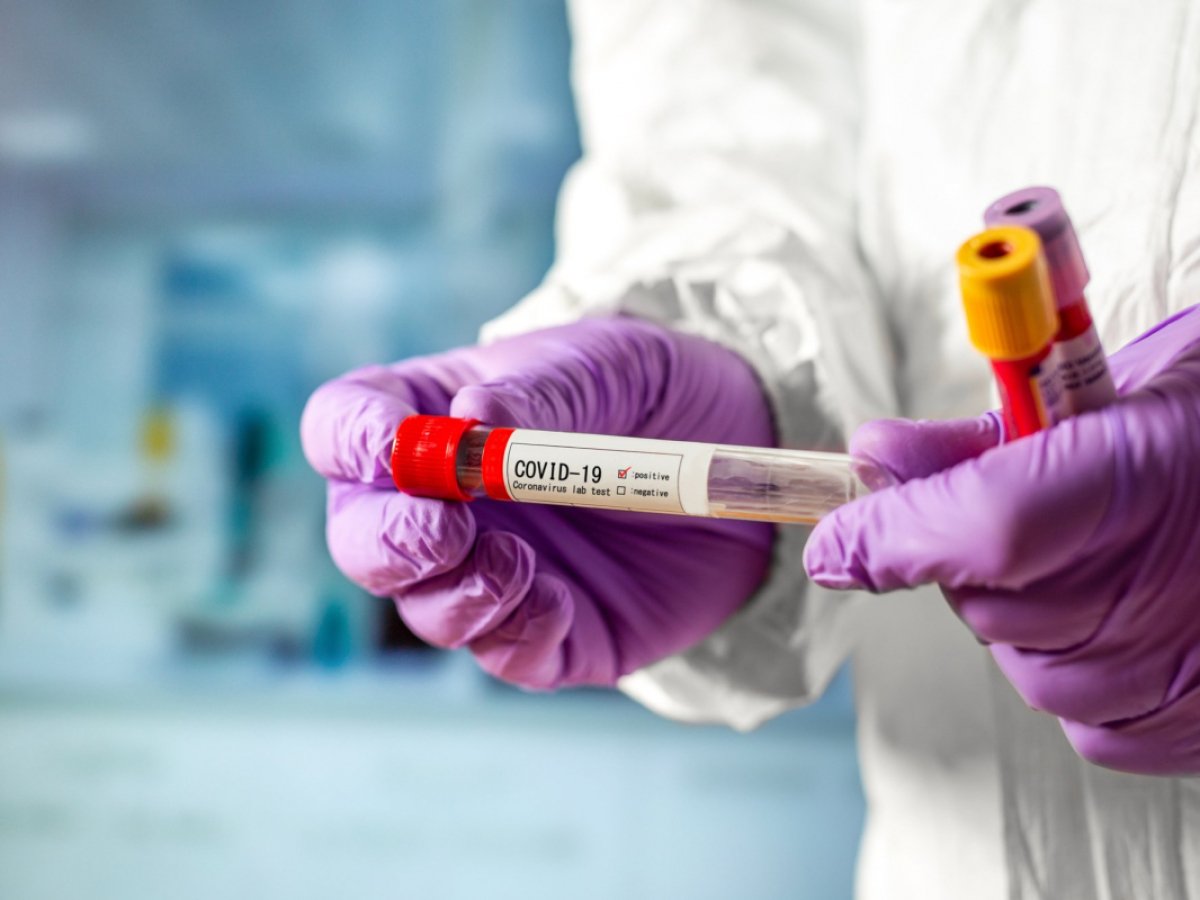 The Ministry of Health has provided recommendations on the need to administer a booster dose of the vaccine after an illness for COVID-19