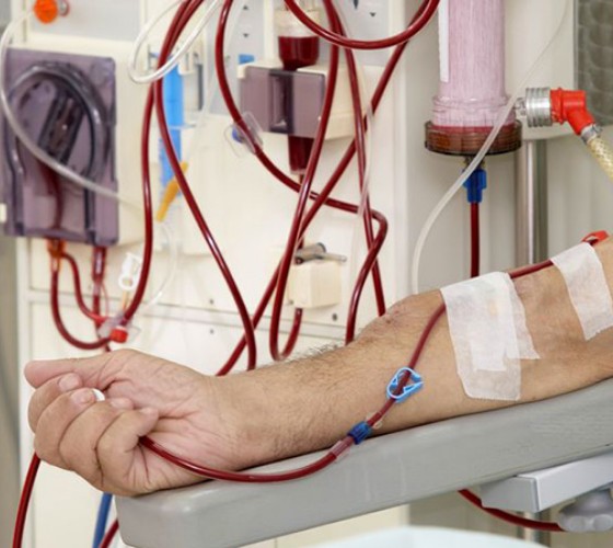 Carrying out dialysis during the war